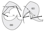 5R parallel manipulator. Path planning