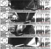 Stable milling of a part flexible in the tool axis direction: vibration and tooth impacts go in phase and the surface is free of marks.