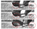 Unstable milling due to period doubling chatter