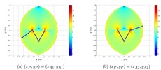 Type III singularities of the 5R mechanism